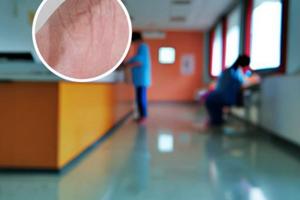 白癜風照完308多久抹鹵米松軟膏