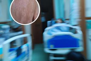 光療311進(jìn)口有嗎是真的嗎