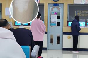 小孩臉上有塊白斑不痛不癢怎么辦