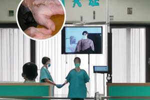 光療儀308多少錢