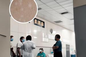 皮膚鏡網(wǎng)狀色沉