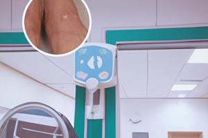 以前白癜風(fēng)為啥不用他克莫司和家用308效果好