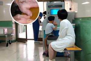 白瘋顛是怎樣引起的