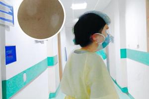 色素脫失癥有哪些診斷方法