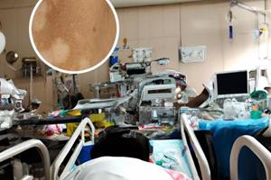 河南省治白癜風(fēng)最好的醫(yī)院是哪個(gè)醫(yī)院