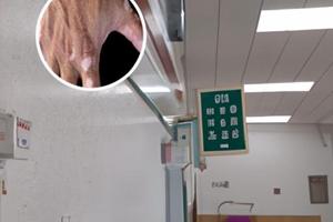 曲安奈德還叫什么