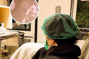 白癜風遺傳多大發病