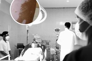 308光線光療對(duì)眼睛有害嗎知乎