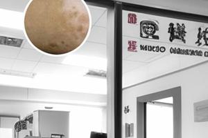 吃什么可以增加黑色素細胞生長功能